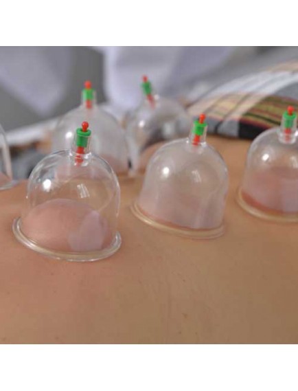 Hacamat Kupa Seti 6 Adet