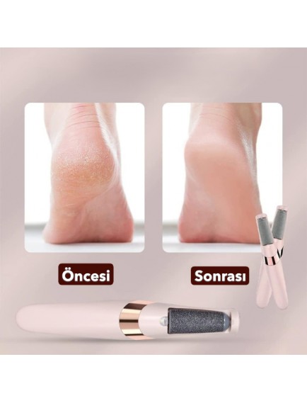 Şarjlı Ayak Törpüsü - Pedikür ve Ayak Bakım Aleti